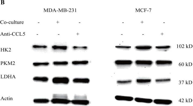 Detection of Human CCL5/RANTES by Western Blot