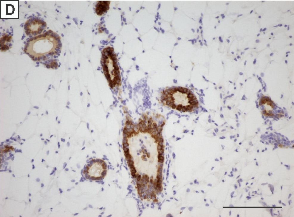 Detection of Mouse IGF-I R/IGF1R by Immunohistochemistry