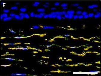 Detection of Human PDGFR alpha by Immunocytochemistry/Immunofluorescence