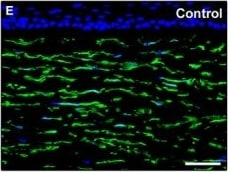 Detection of Human PDGFR alpha by Immunocytochemistry/Immunofluorescence
