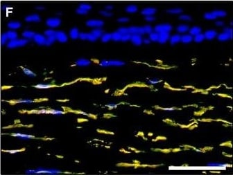 Detection of Human PDGFR alpha by Immunocytochemistry/Immunofluorescence