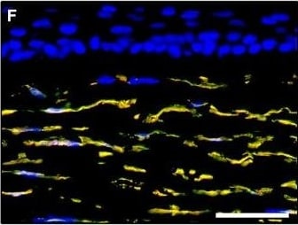 Detection of Human PDGFR alpha by Immunocytochemistry/Immunofluorescence