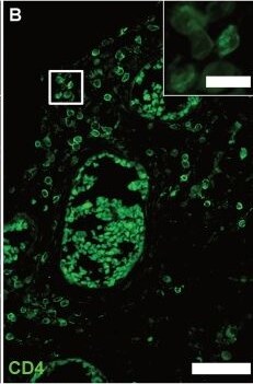 Detection of CD4 by Immunohistochemistry