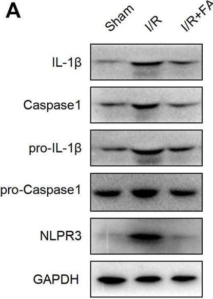 Detection of IL-1 beta /IL-1F2 by Western Blot