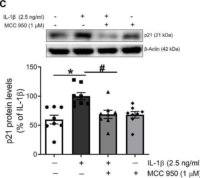 Detection of IL-1 beta /IL-1F2 by Western Blot