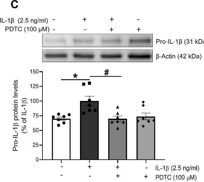 Detection of IL-1 beta /IL-1F2 by Western Blot