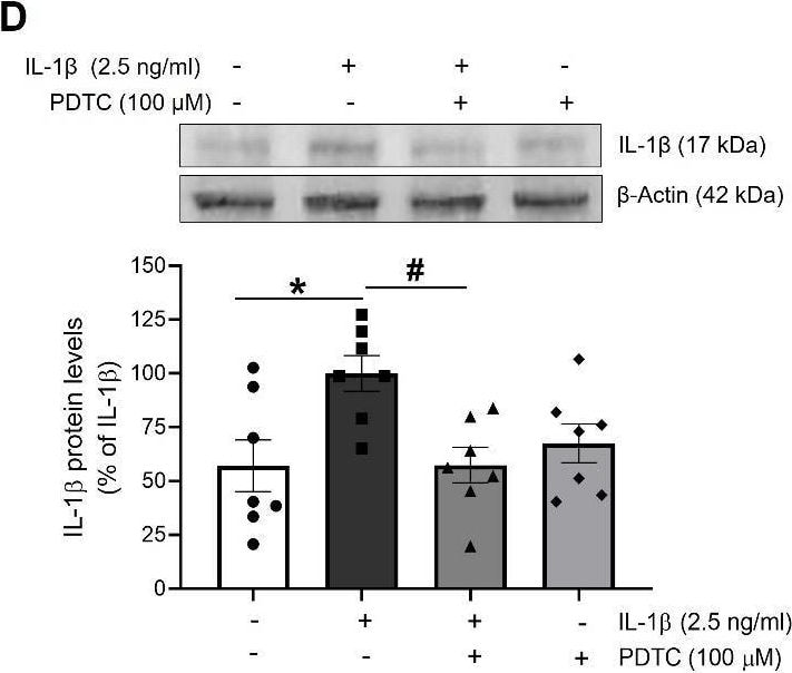 Detection of IL-1 beta /IL-1F2 by Western Blot