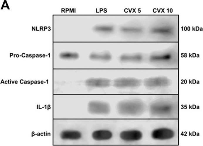 Detection of IL-1 beta /IL-1F2 by Western Blot