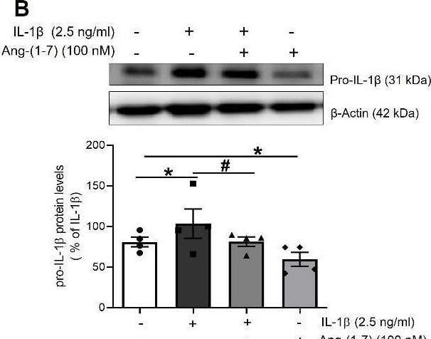 Detection of IL-1 beta /IL-1F2 by Western Blot