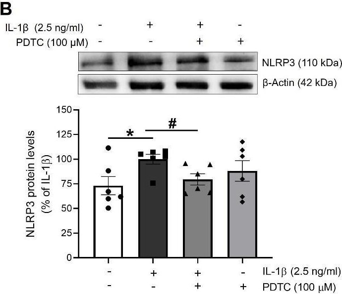Detection of IL-1 beta /IL-1F2 by Western Blot
