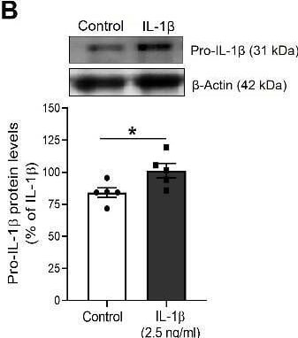 Detection of IL-1 beta /IL-1F2 by Western Blot