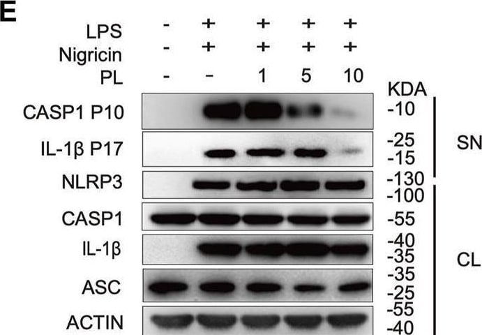 Detection of Mouse IL-1 beta /IL-1F2 by Western Blot