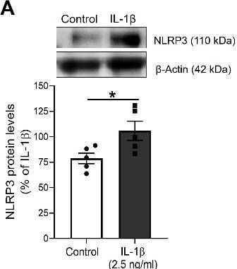 Detection of IL-1 beta /IL-1F2 by Western Blot