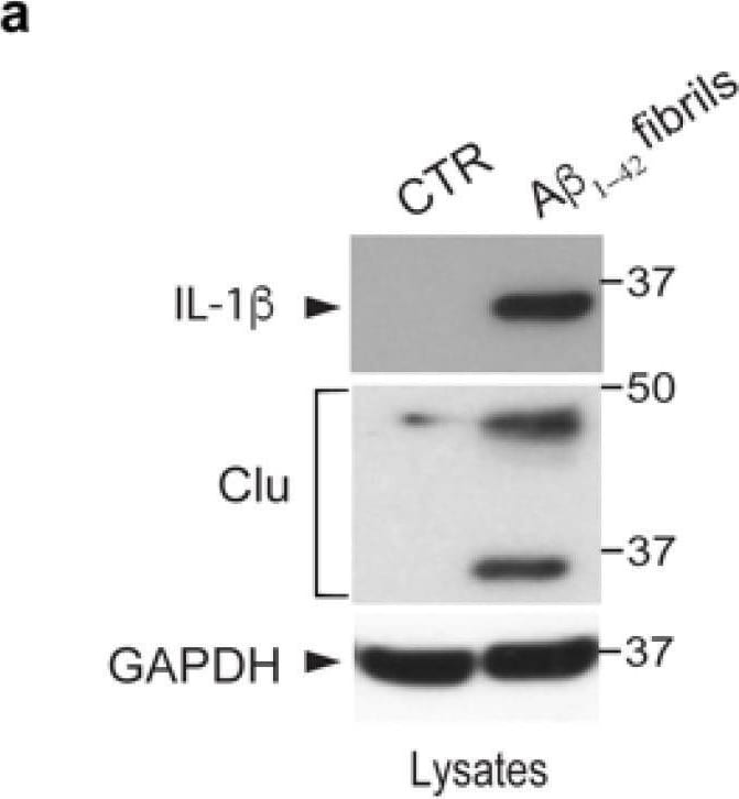 Detection of IL-1 beta /IL-1F2 by Western Blot