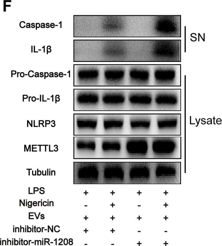 Detection of IL-1 beta /IL-1F2 by Western Blot