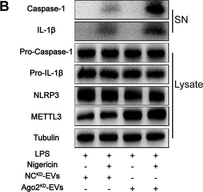 Detection of IL-1 beta /IL-1F2 by Western Blot