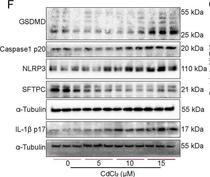 Detection of IL-1 beta /IL-1F2 by Western Blot