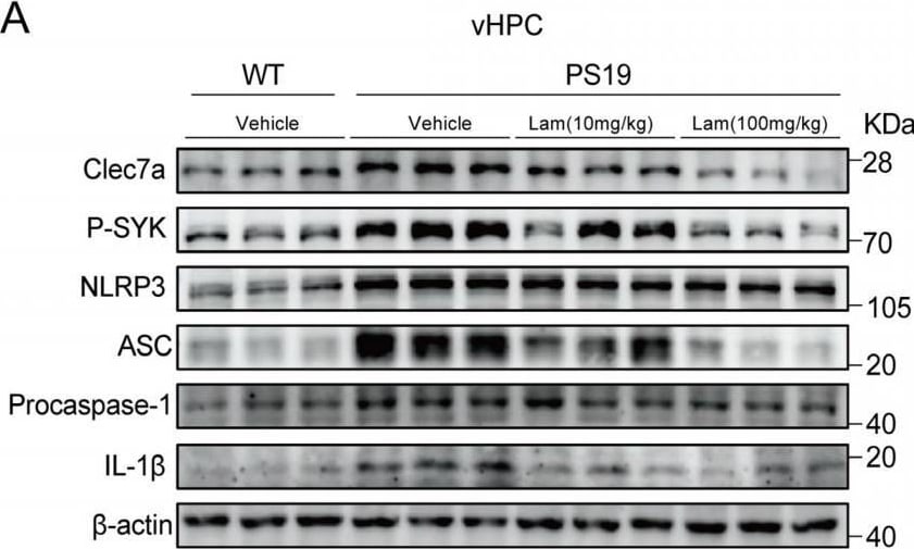 Detection of IL-1 beta /IL-1F2 by Western Blot