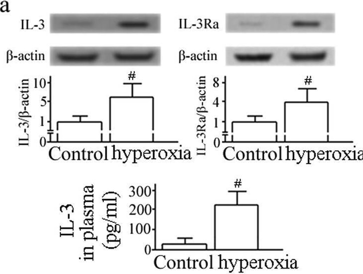 Detection of IL-3 by Western Blot