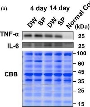 Detection of IL-6 by Western Blot