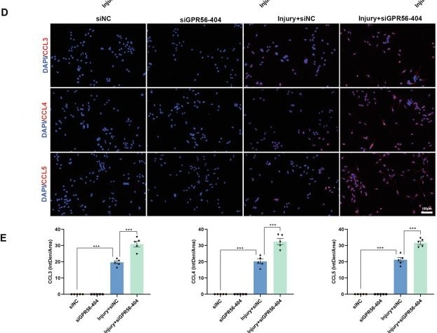 Detection of CCL3/MIP-1 alpha by Immunocytochemistry/ Immunofluorescence