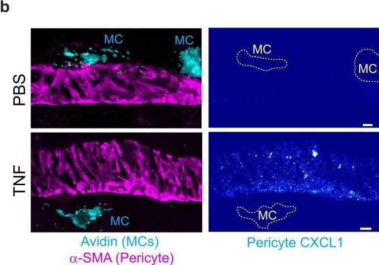 Detection of CXCL1/KC by Immunohistochemistry