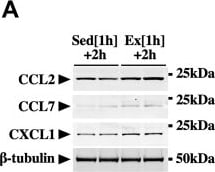 Detection of CXCL1/KC by Western Blot