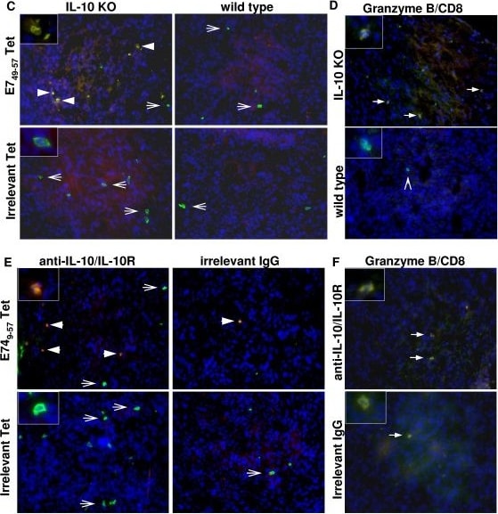 Detection of Mouse IL-10R alpha by Immunocytochemistry/ Immunofluorescence