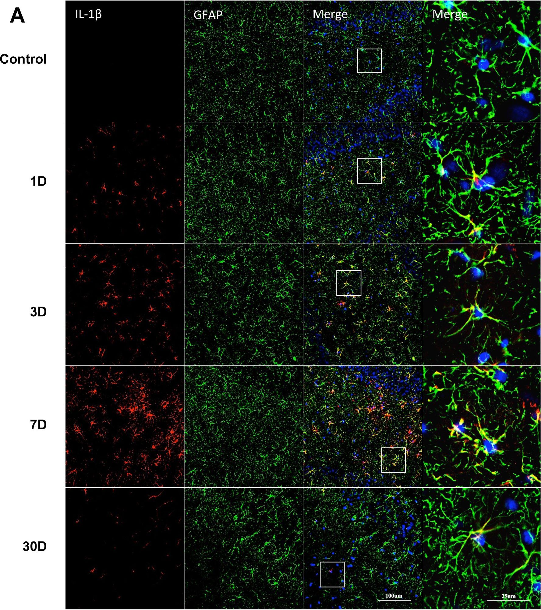 Detection of Porcine IL-1 beta/IL-1F2 by Immunocytochemistry/ Immunofluorescence