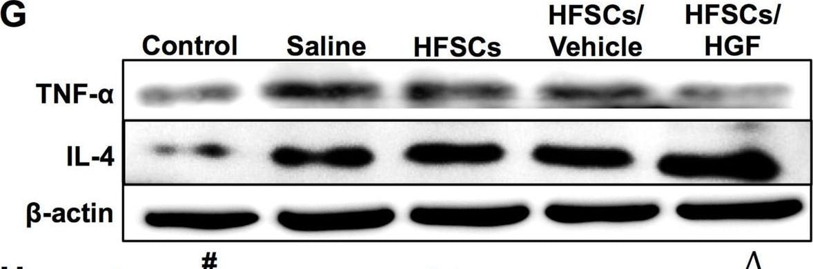 Detection of IL-4 by Western Blot