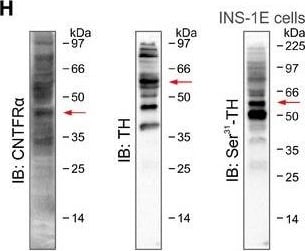Detection of Porcine CNTFR alpha by Western Blot