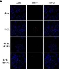 Detection of IFN-gamma by Immunocytochemistry/ Immunofluorescence