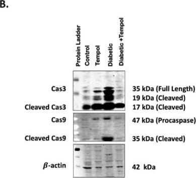 Detection of Caspase-3 by Western Blot