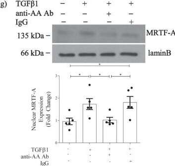 Detection of IgG by Western Blot