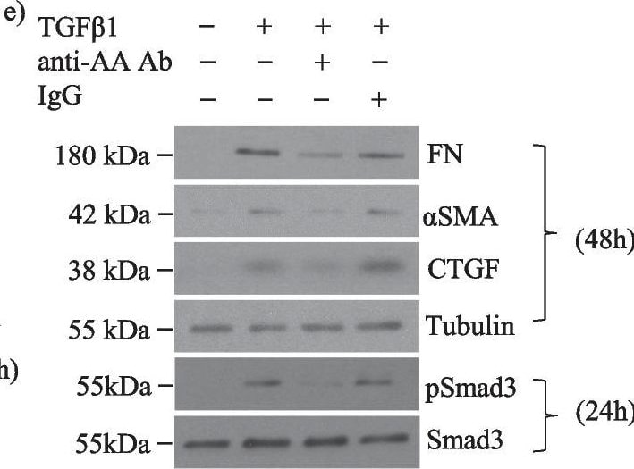Detection of IgG by Western Blot