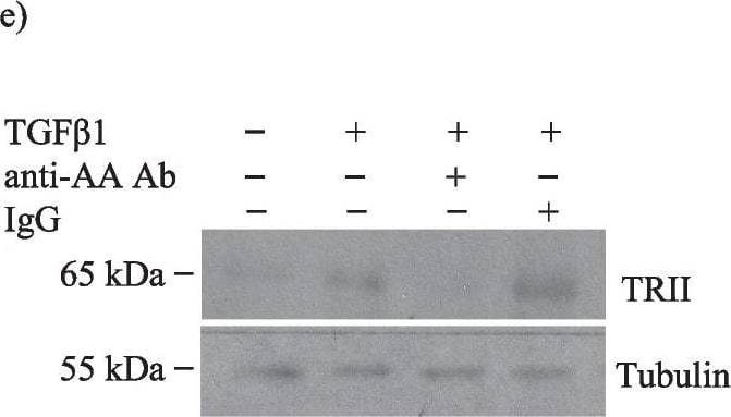 Detection of IgG by Western Blot