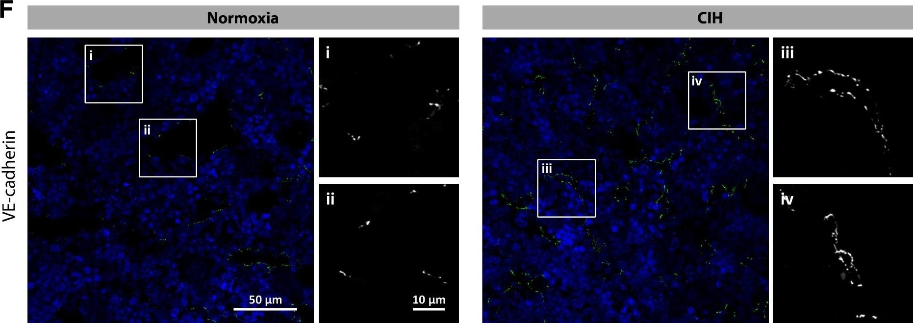 Detection of Rat VE-Cadherin by Immunohistochemistry