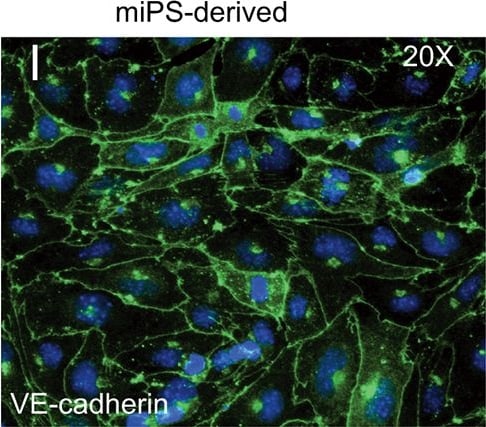 Detection of Mouse VE-Cadherin by Immunocytochemistry/Immunofluorescence