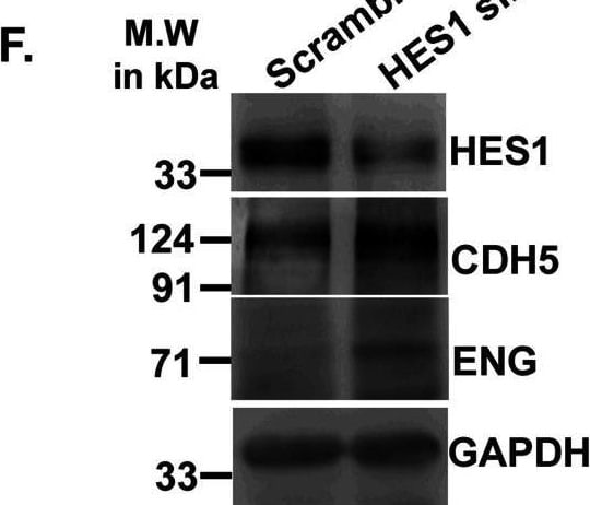 Detection of Mouse VE-Cadherin by Western Blot