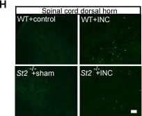 Detection of ST2/IL-33R by Immunohistochemistry