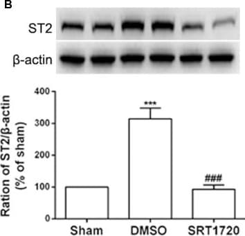 Detection of ST2/IL-33R by Western Blot