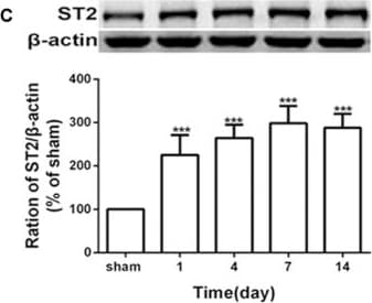 Detection of ST2/IL-33R by Western Blot