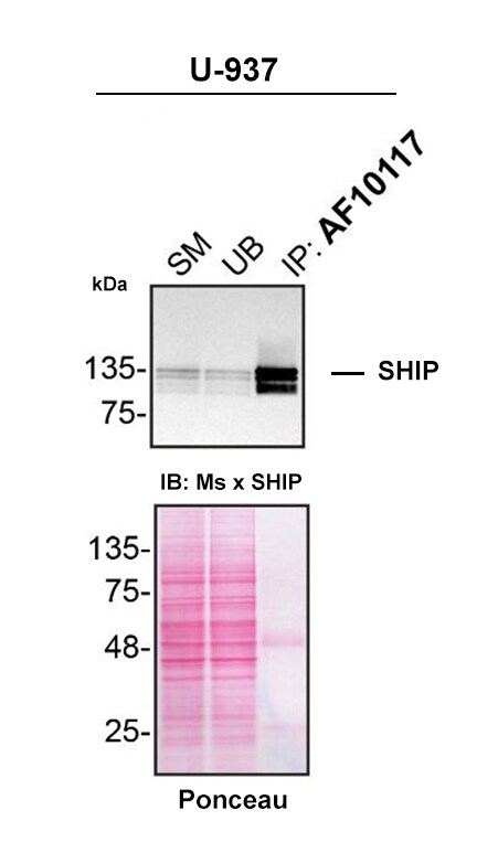 Detection of SHIP by Immunoprecipitation.