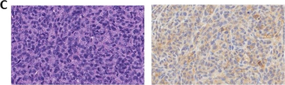 Detection of Mouse Mouse PD-L1/B7-H1 Antibody by Immunohistochemistry