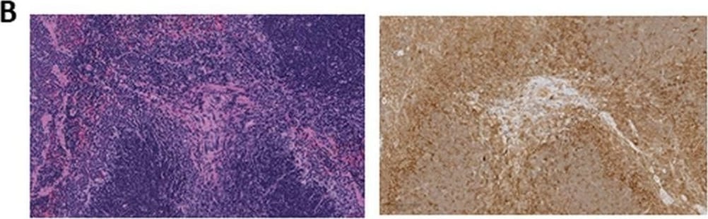 Detection of Mouse Mouse PD-L1/B7-H1 Antibody by Immunohistochemistry