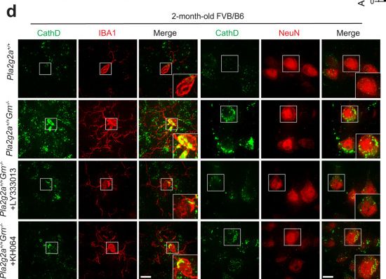 Detection of Cathepsin D by Immunocytochemistry/ Immunofluorescence