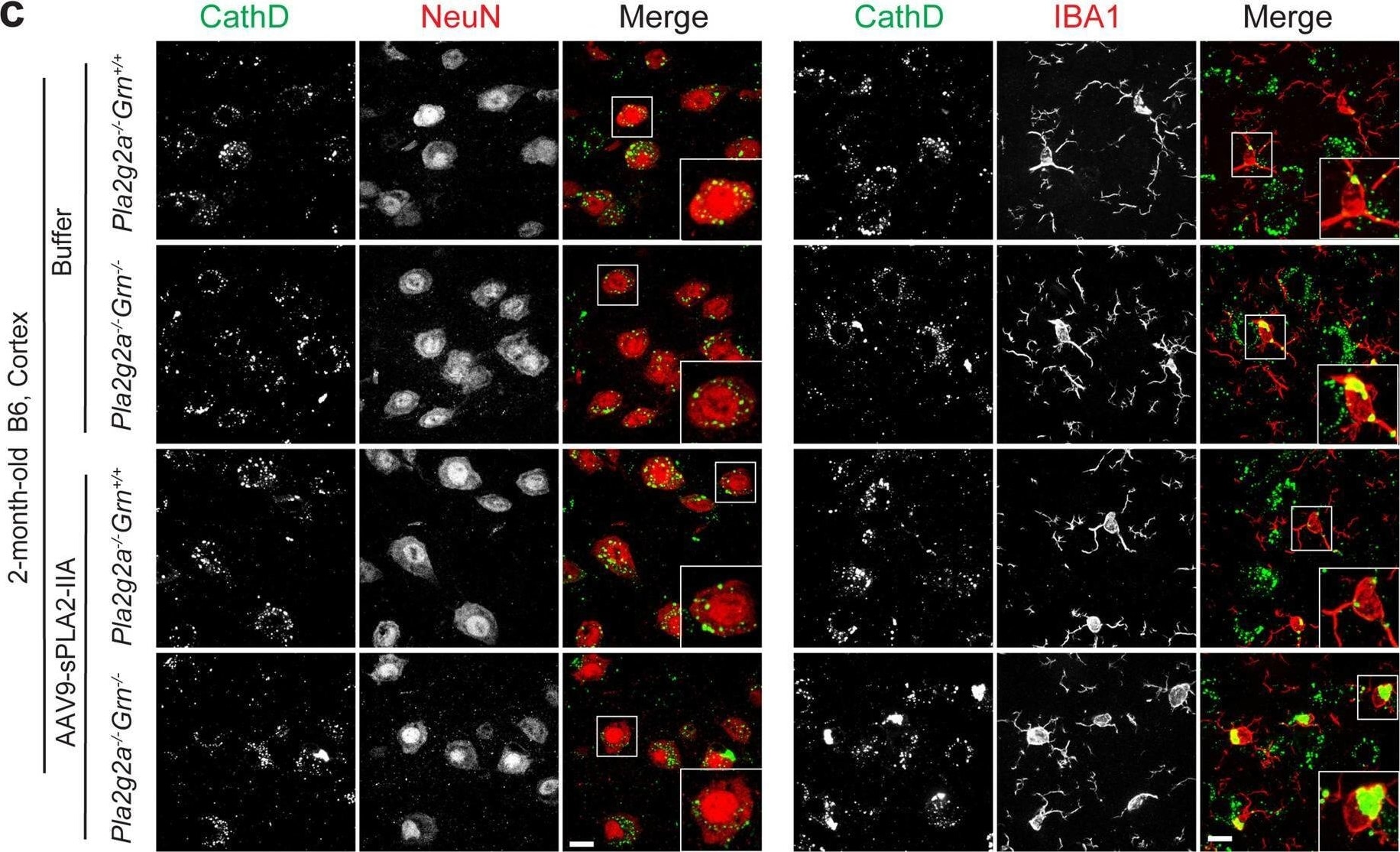Detection of Cathepsin D by Immunocytochemistry/ Immunofluorescence