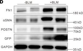 Detection of Cadherin-17 by Western Blot