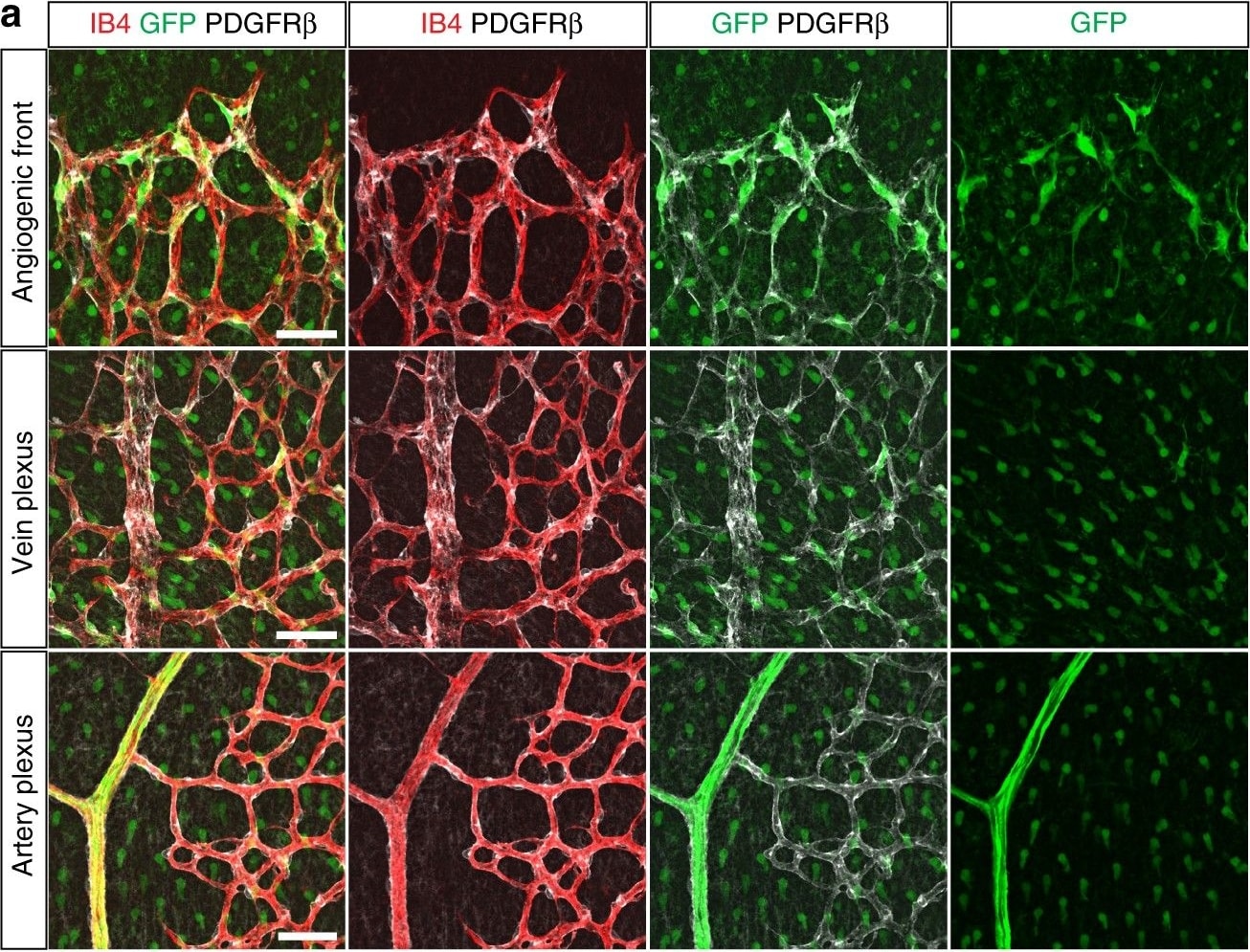 Detection of Mouse PDGF R beta by Immunohistochemistry
