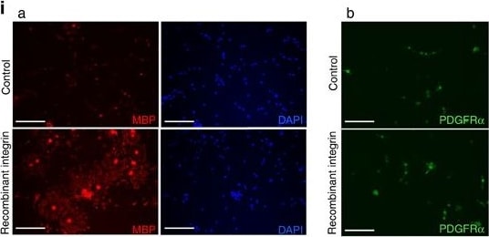 Detection of Mouse PDGF R beta by Immunocytochemistry/Immunofluorescence